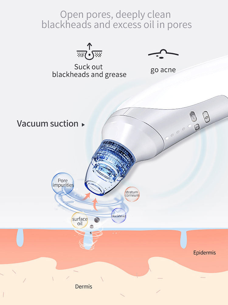 MiraGlow Blackhead Suction Device